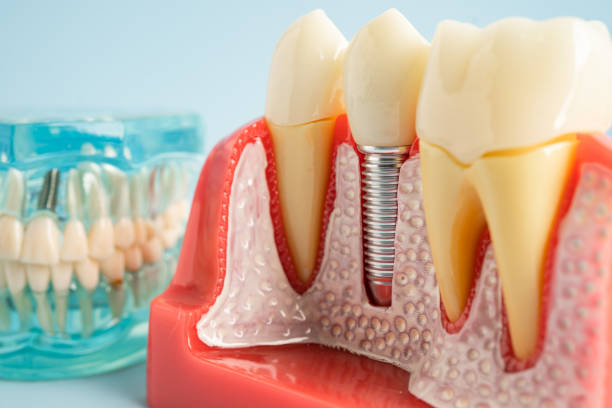 Professional Dental Services in Magna, UT